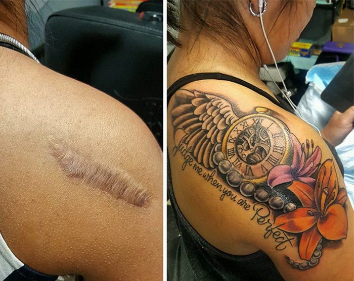 Перекрытие шрамов татуировкой на плече